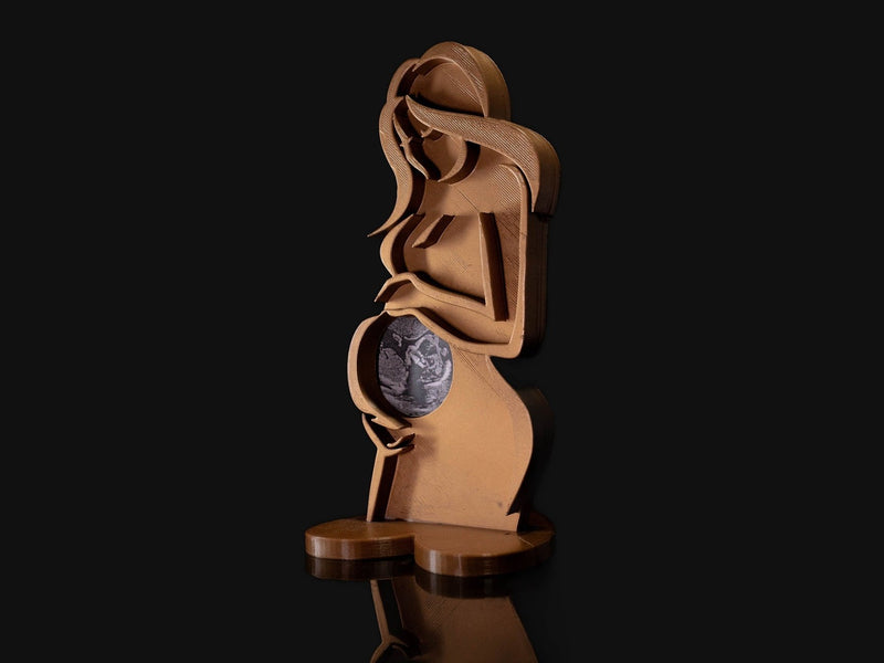 Ultrasound Photo Holder, 3D printed by SealsPrints